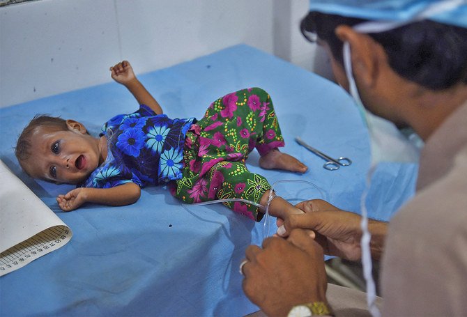 آغا خان یونیورسٹی کی نئی تحقیق سے انکشاف — کراچی میں ہر چار میں سے ایک بچہ نشوونما میں تاخیر کے خطرے سے دوچار